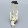 Foot and Ankle with Malleolar Fractures