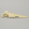 Foot with Flatfoot Condition