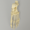 Foot with Flatfoot Condition