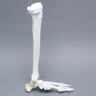 Foot and Ankle, Plastic Cortical, Left