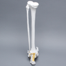Foot and Ankle, Plastic Cortical, Left