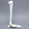 Foot and Ankle, Plastic Cortical, Left