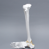 Foot and Ankle, Plastic Cortical, Left