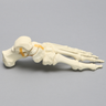 Foot includes a two-part fracture of the talus reattached with latex bands.