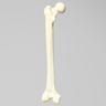 Femur with Transverse Fracture and Fragment