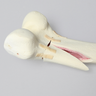 Femur with Transverse Fracture and Fragment