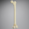 Femur with "T" Fracture