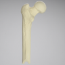 Femur with Osteotomy, Proximal, Foam Cortical Shell