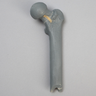 Femur with Neck Fracture, Replacement Part for #1516-39 Trainer