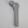 Femur with Neck Fracture, Replacement Part for #1516-39 Trainer