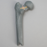 Femur with Neck Fracture, Replacement Part for #1516-39 Trainer