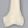 Femur with 3 PCF Cancellous, Foam Cortical