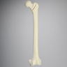 Femur with Intertrochanteric Fracture with Fragment