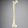 Femur with Intertrochanteric Fracture with Fragment