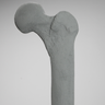 Femur, Radiopaque, Left