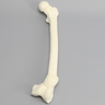 Femur with Nonunion and Malunion