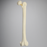 Femur with Neck Fracture