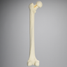 Femur with Neck Fracture