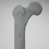Femur, Radiopaque, Right