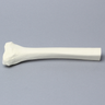 Tibia, Distal, Foam Cortical, Left