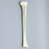 Tibia with Condylar Fracture