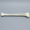 Tibia for IM Nail with Distal Window