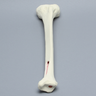 Tibia for IM Nail with Distal Window