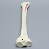 Tibia for IM Nail with Distal Window