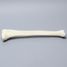 Tibia for High Tibial Osteotomy H.T.O.