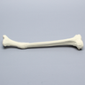 Tibia with Distal Malunion and 25 Degree Varus Defect, Foam Cortical