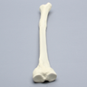 Tibia with Distal Malunion and 25 Degree Varus Defect, Foam Cortical
