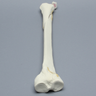 Tibia with Condylar, Malleolar, Oblique, and Spiral Fractures