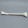 Tibia with Condylar, Malleolar, Oblique, and Spiral Fractures