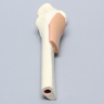 Tibia with Skin Patch and Talus