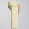Tibia with Skin Patch, Proximal
