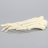 Forefoot with Hammertoe, Foam Cortical, Left, Large