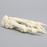 Forefoot with Hammertoe, Foam Cortical, Left, Large