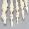 Forefoot with Hammertoe, Foam Cortical, Left, Large