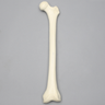 Femur, 14 mm, Trochanteric Entry Site, Foam Cortical