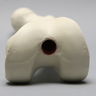 Femur, 14 mm, Trochanteric Entry Site, Foam Cortical