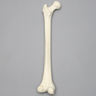 Femur, 14 mm, Trochanteric Entry Site, Foam Cortical