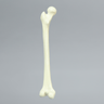 Femur with Neck Deformity, Pediatric