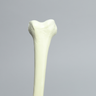Femur with Neck Deformity, Pediatric