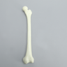 Femur with Neck Deformity, Pediatric