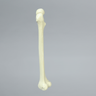 Femur with Neck Deformity, Pediatric