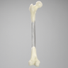 Femur with 9 mm Canal, Transparent, Left, Small