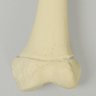 Femur with Defined Distal Growth Plate