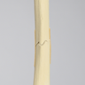 Femur with Transverse Fracture, Foam Cortical, Left, Small