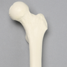 Femur, 9.5 mm Canal, Foam Cortical, Left, Small