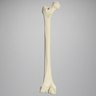Femur with Arthritis, Foam Cortical, Left, Medium